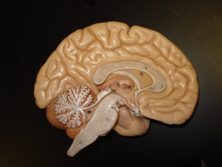 paralysie cerebrale