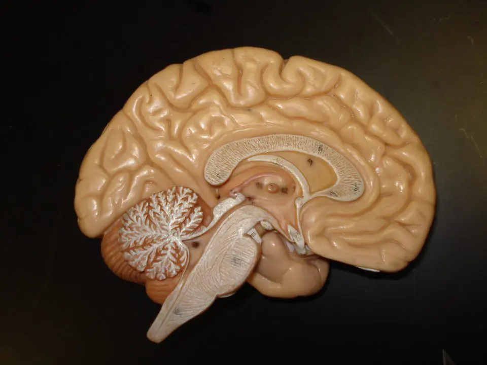 paralysie cerebrale